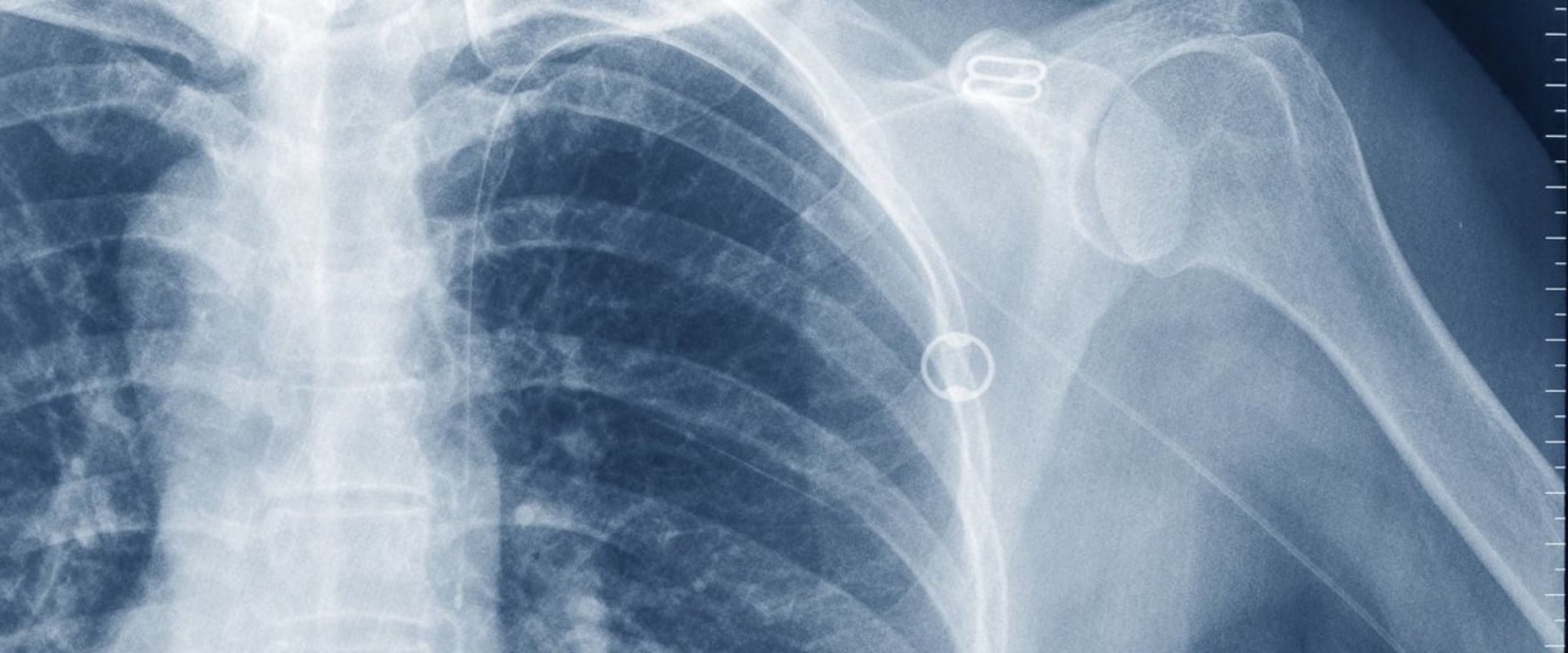 Red Flags to Watch Out for When Interpreting Faxed Results