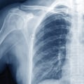 Red Flags to Watch Out for When Interpreting Faxed Results