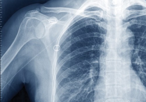 Red Flags to Watch Out for When Interpreting Faxed Results